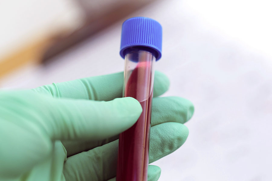 Curso de Patógenos Transmitidos por la Sangre